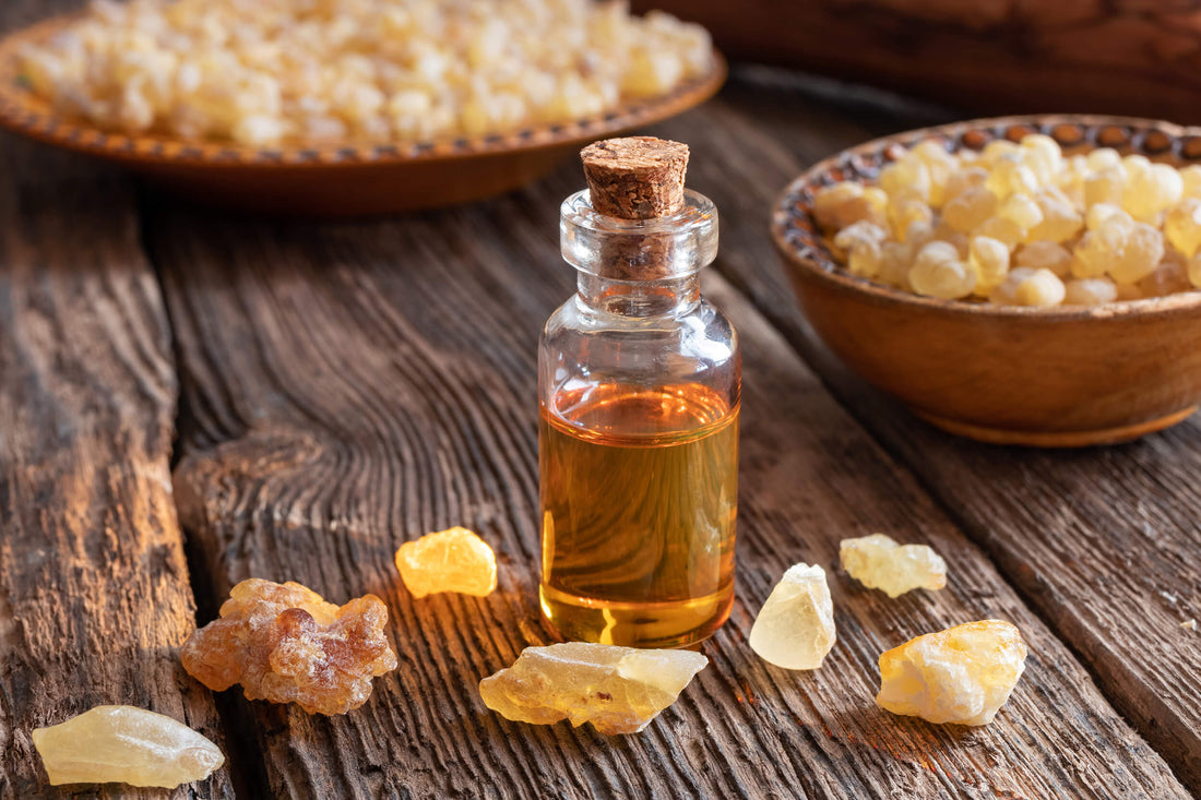 A bottle of frankincense essential oil